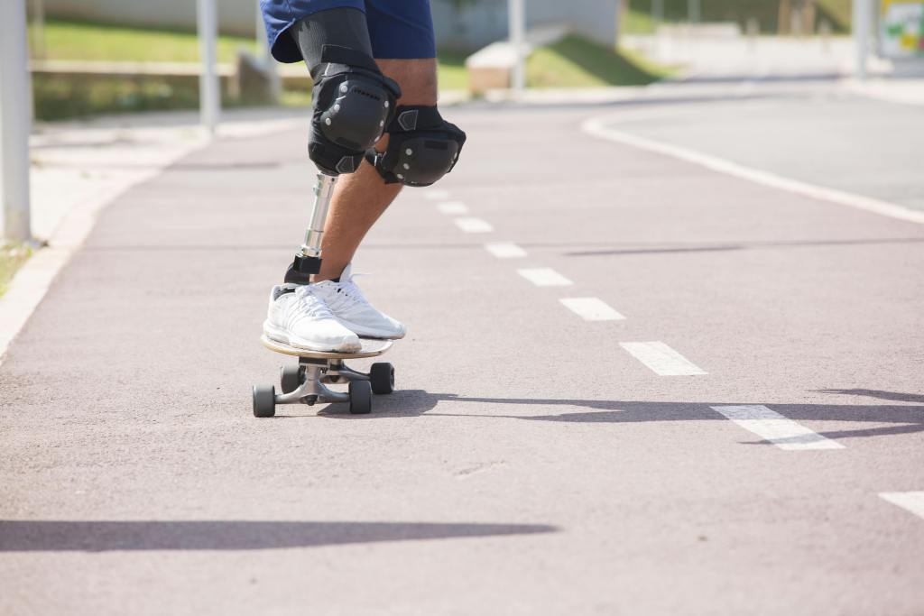 The lower body of a person with kneepads riding a skateboard down an asphault street is pictured. The person has one artificial leg.